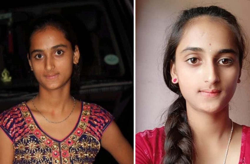  ಸಾವಿನಲ್ಲೂ ಸಾರ್ಥಕತೆ ಮೆರೆದ 18ರ ಯುವತಿ: ಕುಟುಂಬಸ್ಥರ ನಿರ್ಧಾರಕ್ಕೆ ವ್ಯಾಪಕ ಮೆಚ್ಚುಗೆ